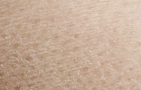 secheresse de la peau menopause secheresse de la peau menopause